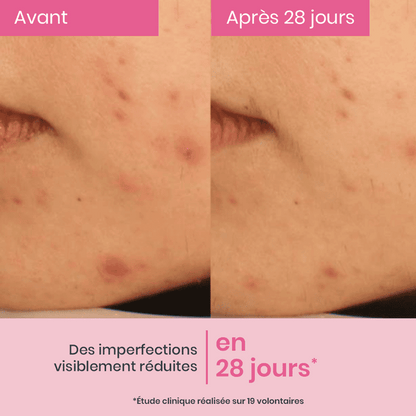 Sérum Concentré Anti-imperfections